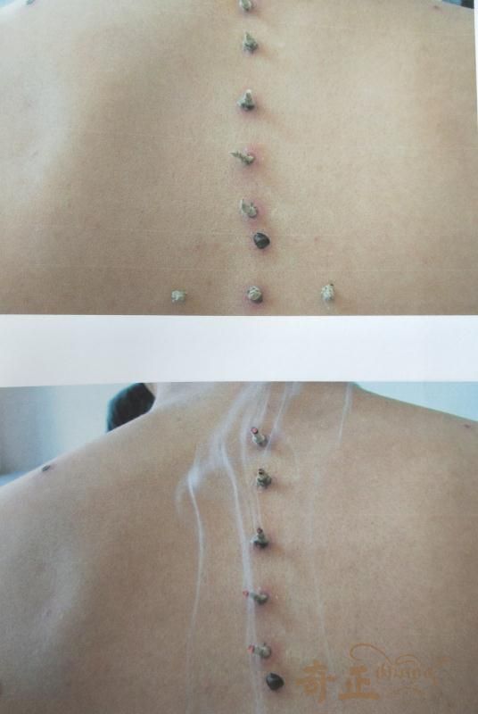 202210111665451040892932